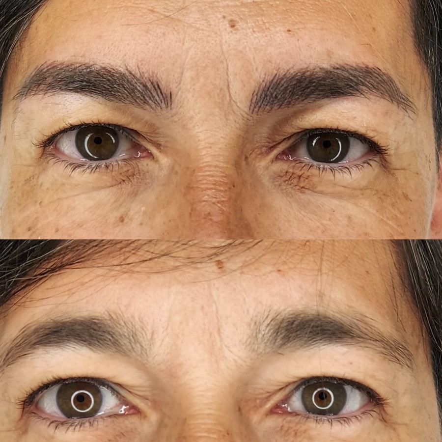 Occhi dopo dermopigmentazione eyeliner sfumato effetto lifting